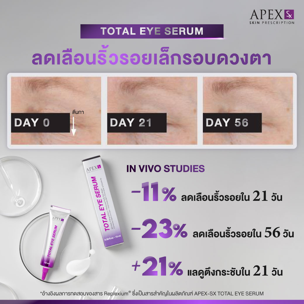 AW_TotalEye_251003_Review-01_0