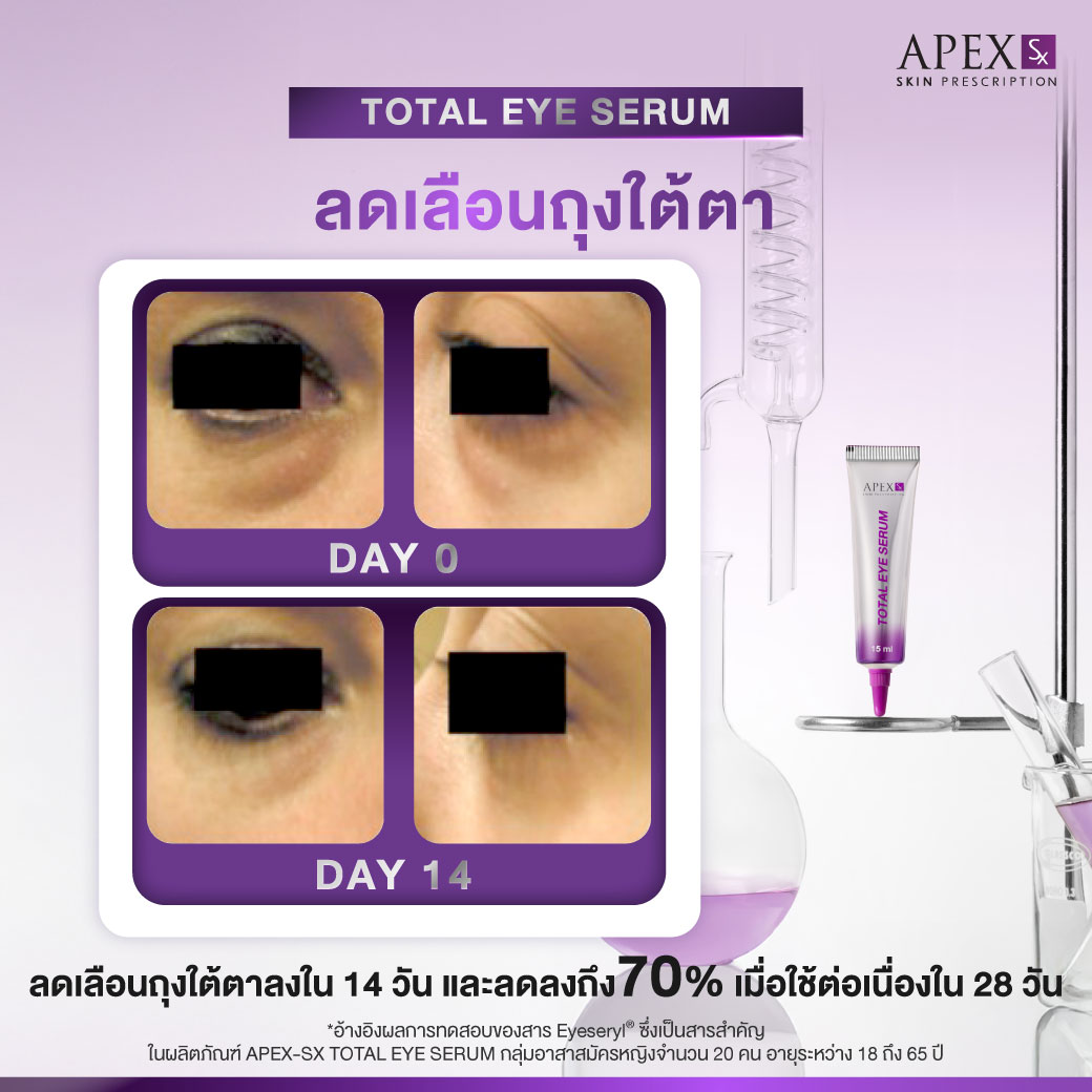 AW_TotalEye_251003_Review-02_0