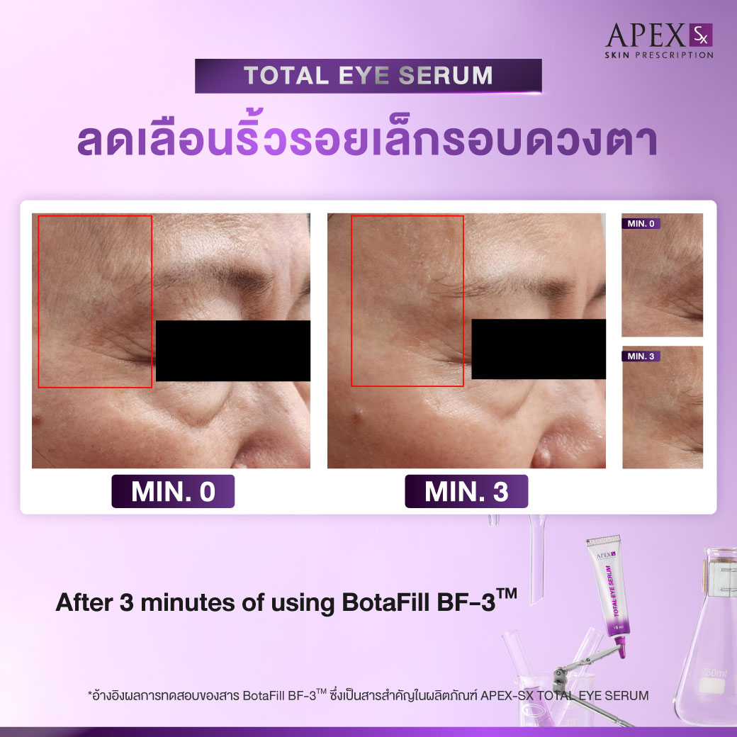 AW_TotalEye_251003_Review-03_0