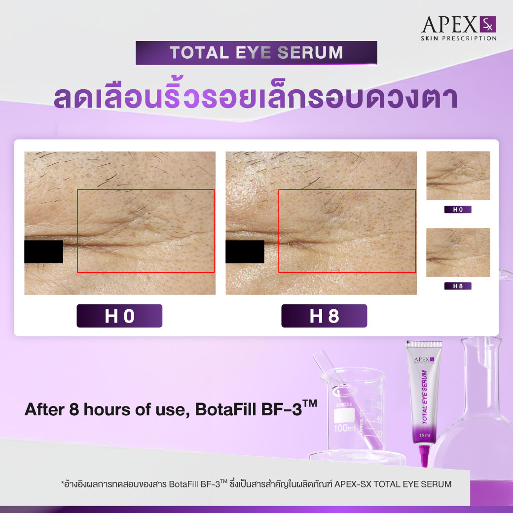 AW_TotalEye_251003_Review-04_0