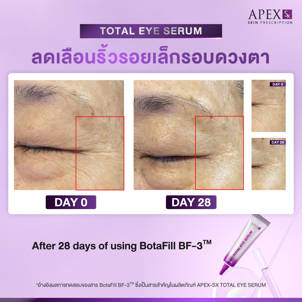 AW_TotalEye_251003_Review-05_0